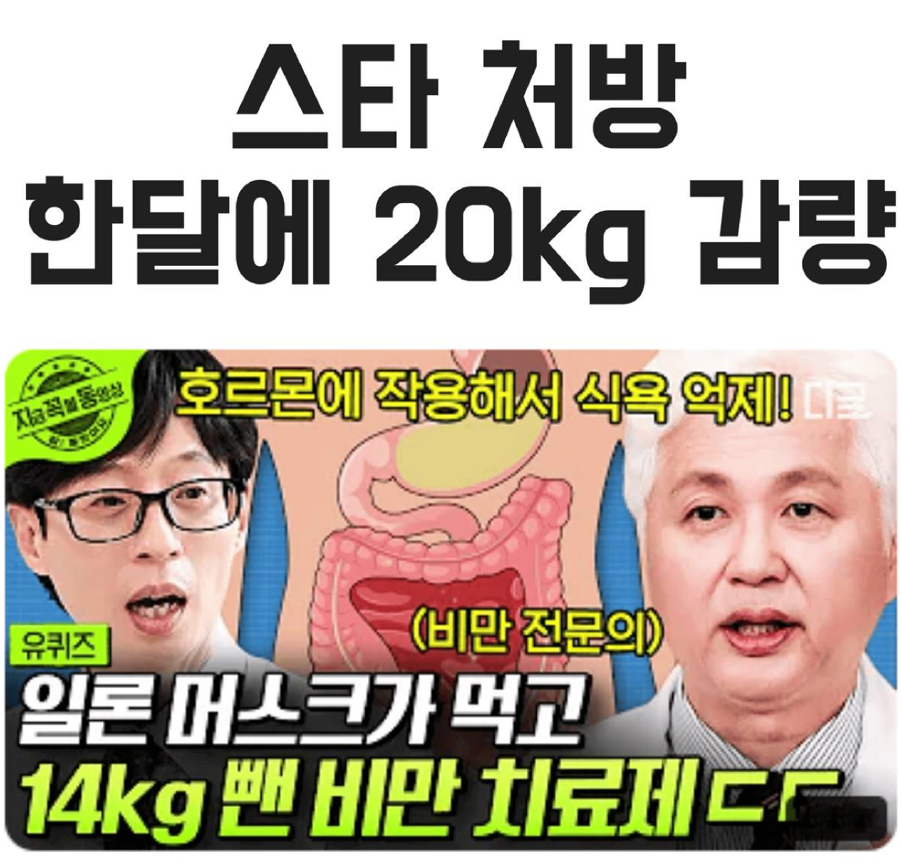 스타 저방 한달에 20kg 감량