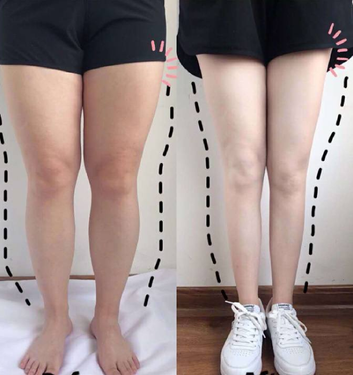 다리 슬림해진 비교